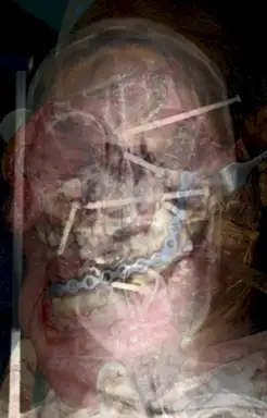 Welcome to Die
