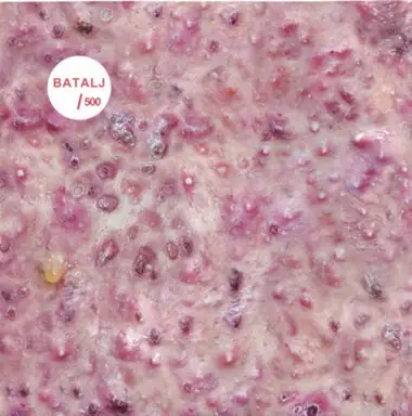 Batalj
